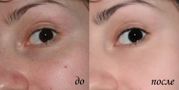 Ретушь кожи с сохранением текстуры