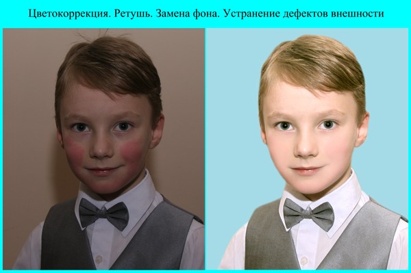 Цветокоррекция, ретушь, замена фона, устранение дефектов внешности