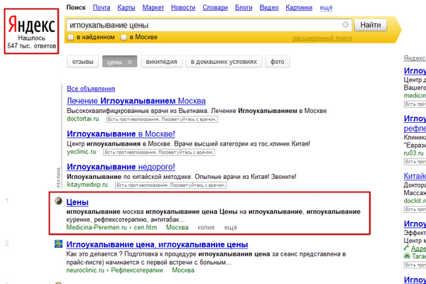 Иглоукалывание цены