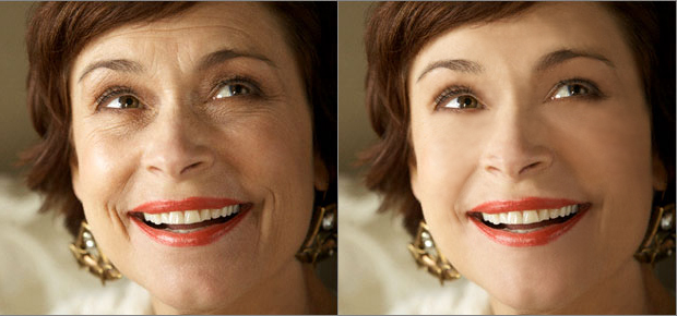 Омоложение