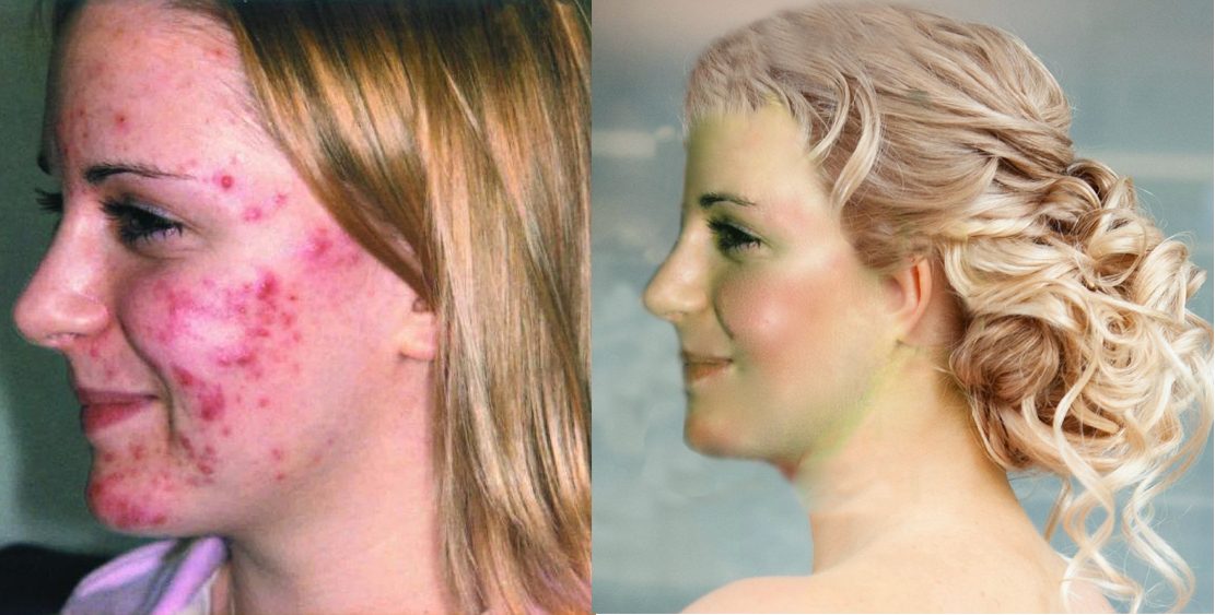 Фоторетушь