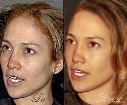 ретуш интернет фото