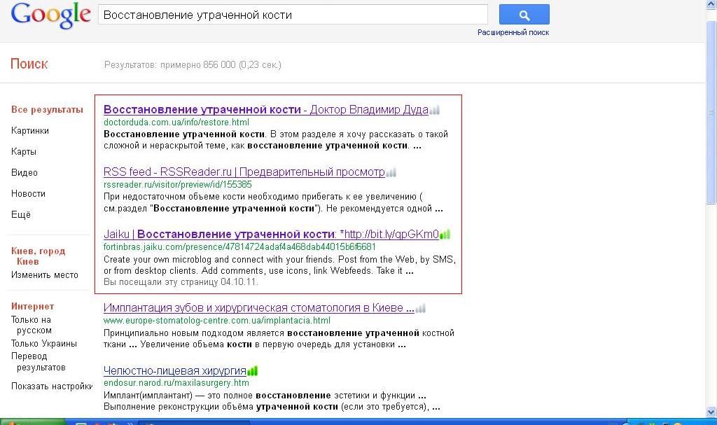 Восстановление утраченной кости, Гугл